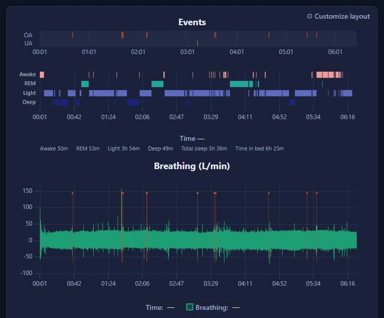 A night in Breathing Room: the event timeline and sleep stages above the breathing waveform, with each apnea marked.