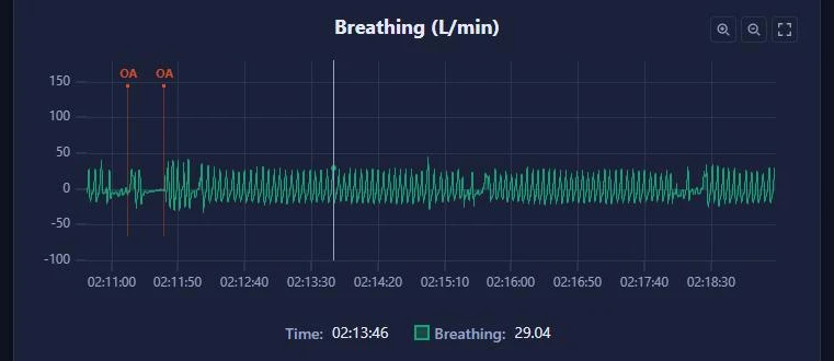 Eight minutes of the breathing waveform, zoomed in to single breaths, with two obstructive apneas marked.